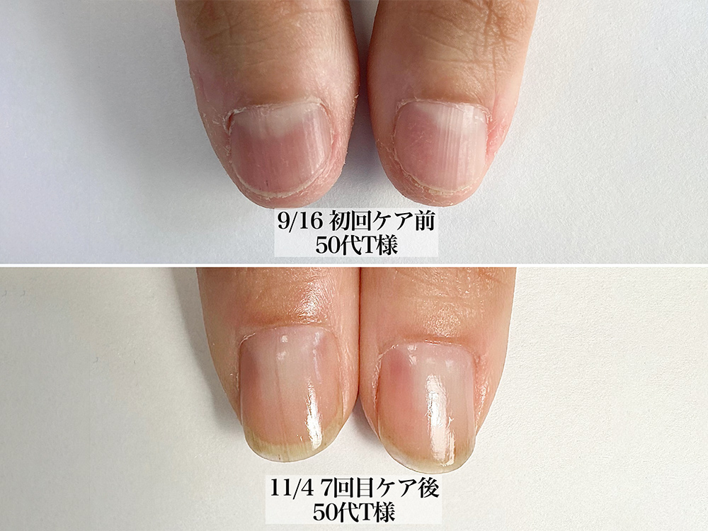 最強ネイルケア